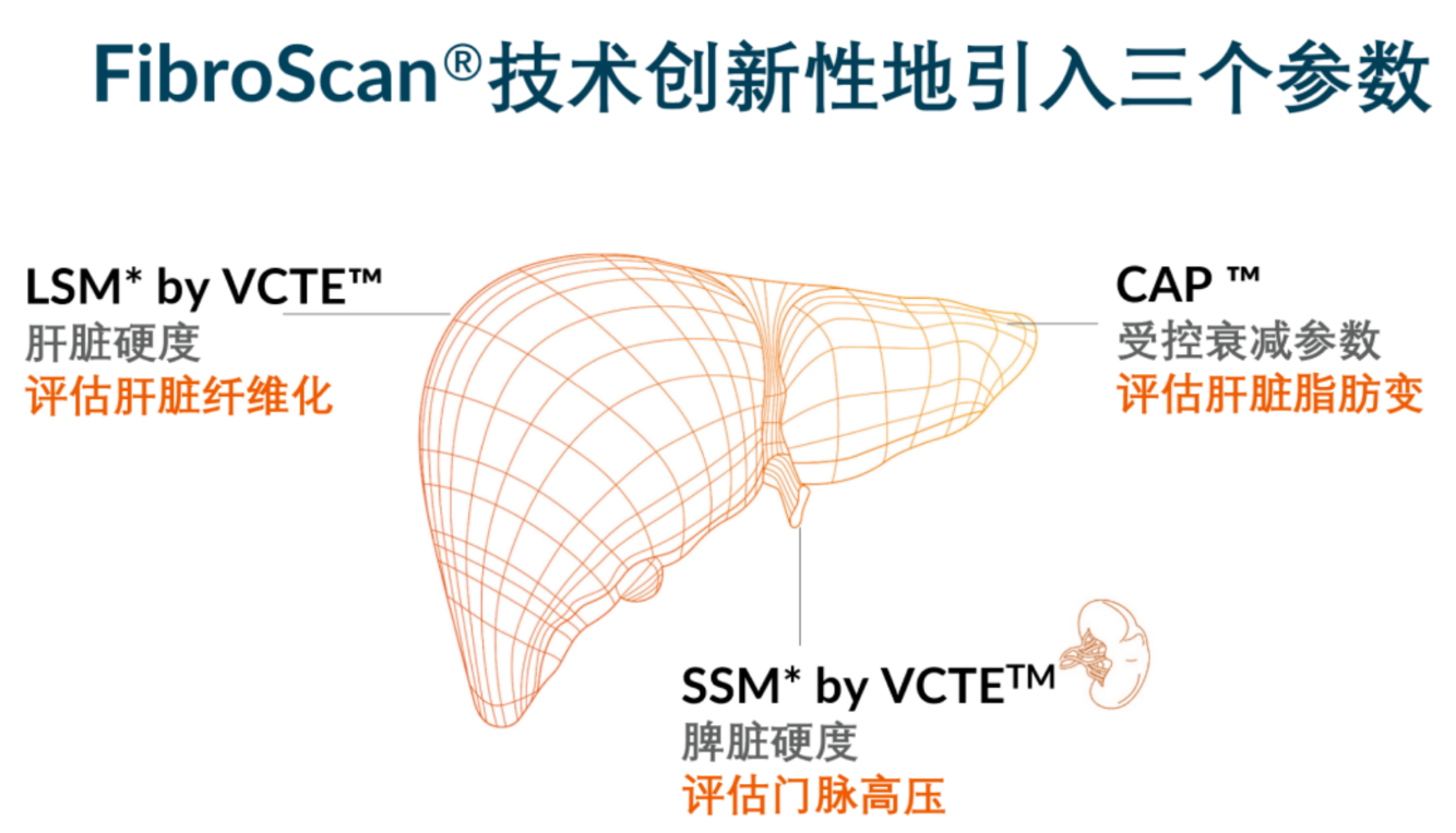 喜訊！FDA擴大了FibroScan?在肝臟綜合管理中的應用范圍